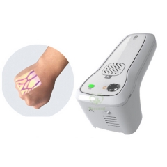 MY-G060A hospital portable infrared Medical Vein Viewer System handheld Vein Finder for patient